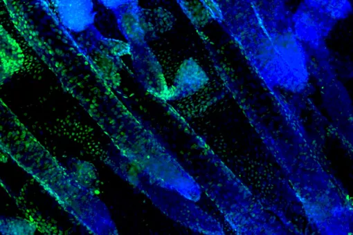 Células madre de la piel. En azul, marcador para el núcleo celular. En verde, marcador para la proteína Dnmt3a, indispensable para que las células conserven las características de célula madre (Lorenzo Rinaldi, IRB Barcelona)