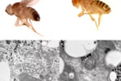 On the right side we can see aberrant fly and mitochondria when SLIMP is silenced.