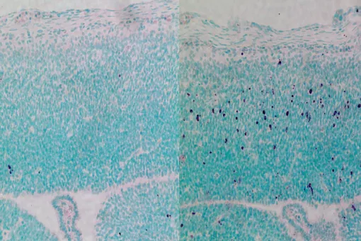 La falta de CEP63 incrementa la muerte de células madre en un cerebro de ratón en desarrollo. La imagen de la derecha muestra en violeta células madre en muerte celular. Los ratones nacen con microcefalia, característica del Síndrome de Seckel (Berta Terr