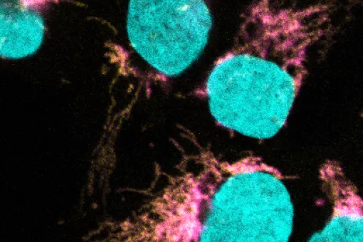 Confocal microscopy shows co-localization of EXD2 (magenta) with the mitochondrial ribosome (yellow). DNA is stained to define the nucleus (cyan).