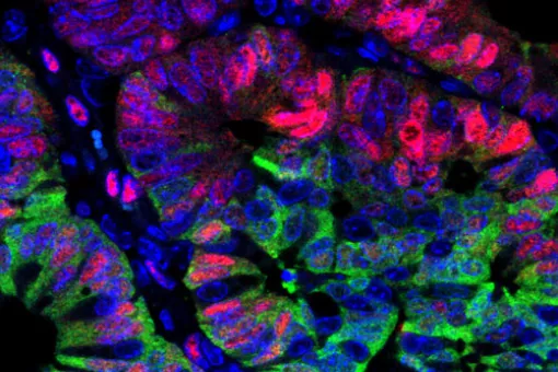 Eduard Batlle heads a study published in Nature Cell Biology on Sunday 22 June (Photo: Gavin Whissell , IRB Barcelona)
