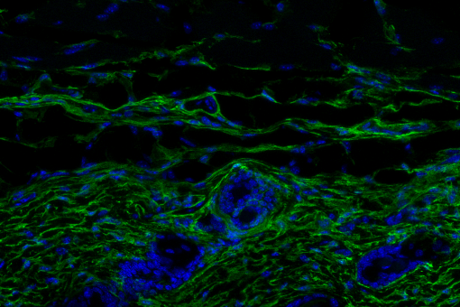 Pell de ratolí jove. Secció de la pell amb els fibroblasts marcats en verd. El gruix de la dermis i densitat de fibroblasts és molt més gran en ratolins joves que en ratolins envellits -en blau, nuclis cel·lulars (Marion Salzer, IRB Barcelona)