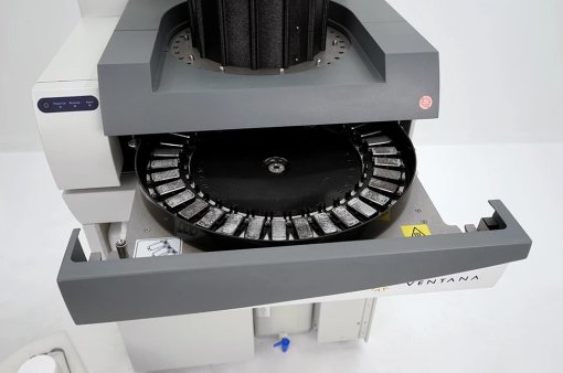 Ventana Discovery XT – Roche