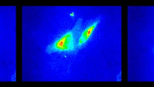 Fluorescence microscope image 