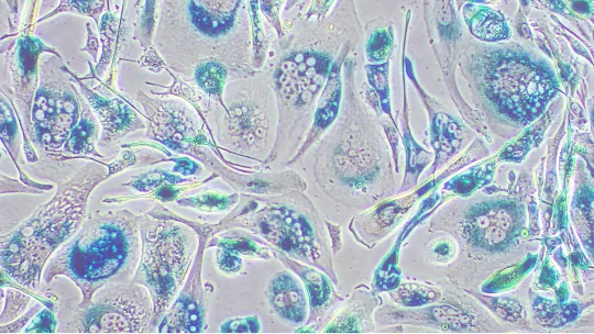 Senescent tumor cells, mouse pancreatic cancer cell culture. 