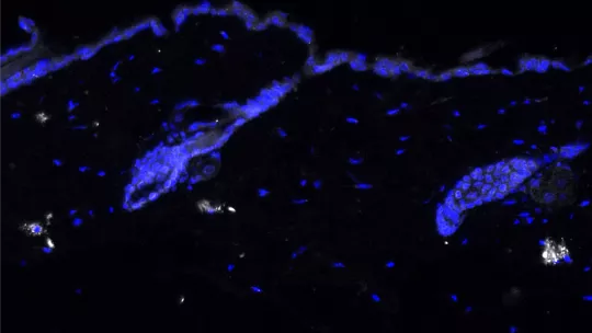 Immunofluorescence staining of IL-17(white) in aged mouse skin