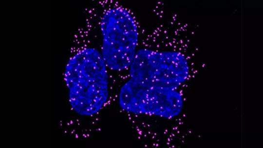 Proximity labeling reveals interaction between Heca and a key stress granule protein in human HeLa cells following stress induction (magenta). Cell nuclei are stained in blue.