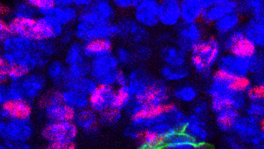 En condicions normals de l'intestí, després de tres dies, les cèl·lules mare quiescents (en verd) no es divideixen en comparació amb la resta de cèl·lules de l’intestí amb alta taxa de divisió (F. Barriga, IRB Barcelona). 