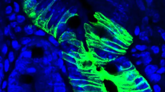 Despúes de aplicar quimioterapia, las células quiescentes cambian su comportamiento, se activan y regeneran todos los tipos celulares en el intestino (en verde). (F Barriga, IRB Barcelona)