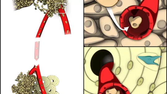 Gráfico de metástasis de un tumor primario de mama a huesos (Autor: Formas Naturales para Inbiomotion, IRB Barcelona)