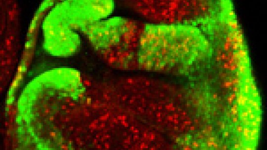 Notch activation (green) and cell proliferation (red) in the Drosophila wing primordium