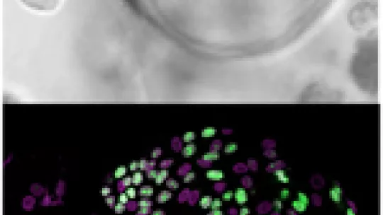 Individual intestinal stem cells generate spherical organoids when grown in lab-plates (upper pannel). Under the microscope (lower pannel), these organoids reveal to be composed mostly by undiferentiated and proliferative cells, the intestinal stem cells