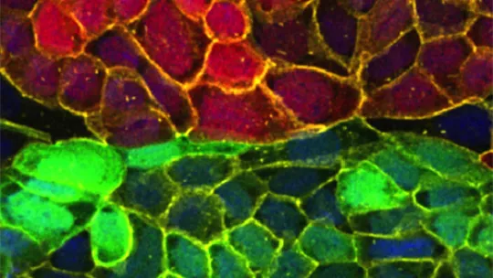 Poster of the "Cancer, Metastasis and Personalized Medicine" course