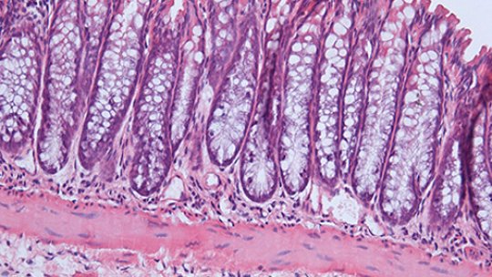 Picture of a healthy colon (Author: J Gupta, IRB)