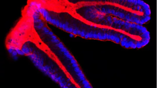 Imagen de microscopía de un epitelio de colon sano (Imagen: Alexandre Calon, IRB Barcelona)