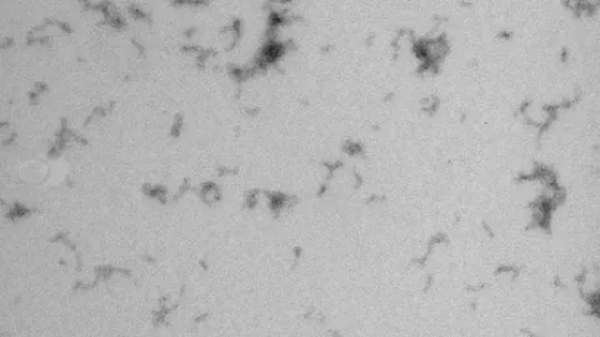 Small aggregates of beta amyloid (Copyright: Carulla, IRB Barcelona)