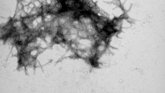 Amyloid fibrils are the main component of the plaques. (Copyright: Carulla, IRB Barcelona)