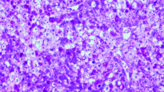 Muestra de hígado de ratones. Alto contenido en glucógeno (fucsia) hace que ratones coman menos y mejoren la diabetes y la obesidad. Imagen: I. López-Soldado, IRB Barcelona