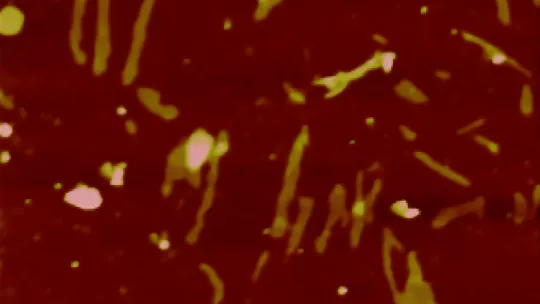 La proteína Receptor de Andrógenos forma agregados que dañan las células musculares y las neuronas motoras en la Enfermedad de Kennedy (B. Eftekharzadeh, IRB Barcelona)