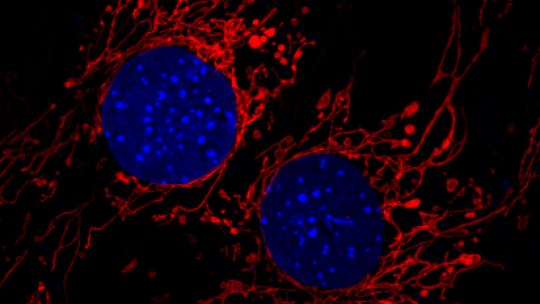 Cells with elongated mitochondrial network in red. Image: David Sebastián, IRB Barcelona