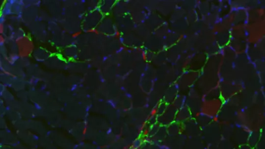 Imagen: Worldwide Cancer Research. 