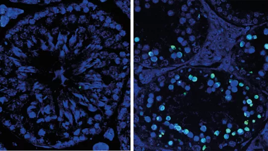 Estructura microscópica de tejido testicular de ratón. Izquierda, detalle de túbulo seminífero sano con espermátidas y espermatozoides. Derecha, los túbulos se encogen debido a la muerte masiva de células germinales (en verde). (P. Mikolcevic, IRB Barcelo
