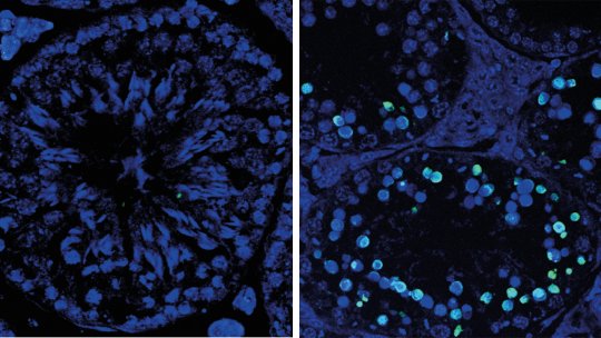 Estructura microscòpica de teixit testicular de ratolí. Esquerra, detall de túbul seminífer sa amb espermàtides i espermatozoides. Dreta, els túbuls s'encongeixen per la mort massiva de cèl·lules germinals (en verd). (P. Mikolcevic, IRB Barcelona)