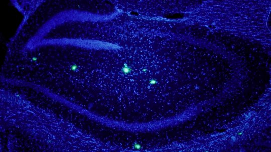 La beta amiloide està fortament vinculada a Alzheimer; encara cal revelar com hi influeix. Mostra de cervell de ratolí que sobreexpressa beta amiloide. En blau, nuclis neuronals. En verd, algunes plaques de beta amiloide (E.Verdaguer/S.Brox)