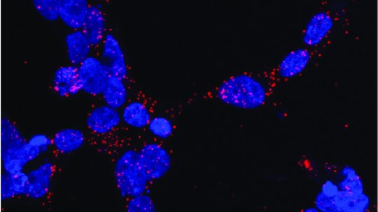Interaction of the androgen receptor and chaperone Hsp70 (in red) inside the cell. Blue indicates cell nuclei. Xavier Salvatella, IRB Barcelona.