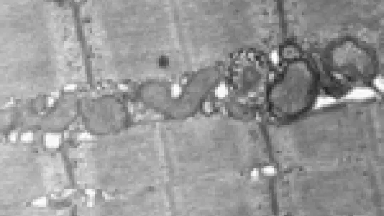Mitochondrial autophagy in skeletal muscle