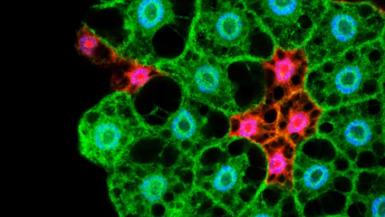 Microscopy image showing cells of the fat body. In Drosophila the storage and management of energy is regulated by cells from this tissue (Lara Barrio, IRB Barcelona)