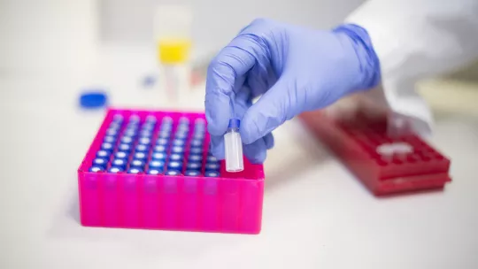 El proyecto Spark busca desarrollar un medicamento para tratar la esquizofrenia (Foto: Iproteos y G. Battista) 