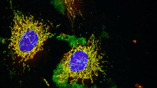 Blood vessel cells activate a series of proteins that switch on apoptosis (programmed cell death) in order to self-renew. (Microscope image: J Urosevic, IRB)