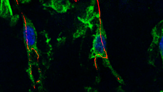 Cèl·lules terminals d'una branca de la tràquea. Les cèl·lules centrals són les que fan les ramificacions. En verd microtúbuls, en vermell el lumen i en blau el nucli. (Sofia J. Araujo)