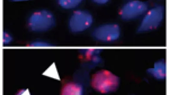 The localization of CenH3 protein in the centromere (upper panel) becomes inespecific along the chromosome (lower panel) when its regulated degradation is unpaired.