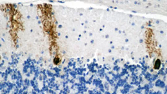 Comparative microscope images. The lower picture shows a cerebellum sample from a healthy mouse. Above, the same tissue after glycogen accumulation. (Jordi Duran. IRB Barcelona)