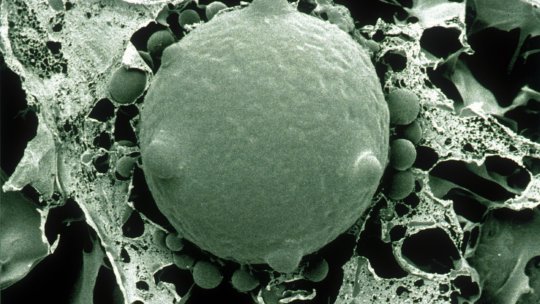 Chytrid fungus - Scanning electron microscope (CSIRO Science Image)