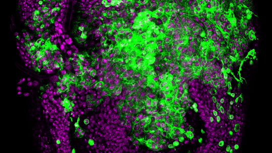 Epitelio de Drosophila sometido a inestabilidad cromosómica (CIN): las células comienzan a invadir los tejidos vecinos. En magenta, núcleos del epitelio y, en verde, membranas de las células sometidas a CIN (L Barrio, IRB Barcelona)