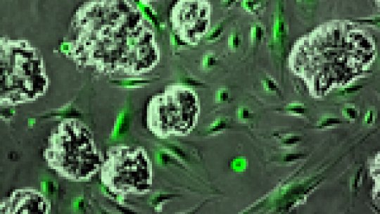 Microscopy images of growing colon cancer cells surrounded by stroma cells, mainly fibroblasts  (in green) © E. Batlle lab, IRB Barcelona. Autor: Alexandre Calon