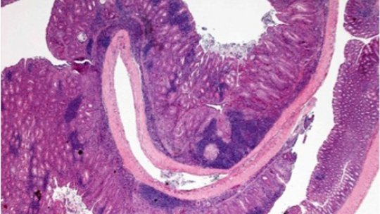 Imagen de microscopía del colon de un ratón con inflamación crónica y tumores planos (Imagen: R. Batlle)