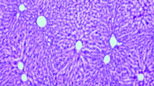 Muestra de hígado de ratones. La imagen muestra niveles de glucógeno (fucsia) en el hígado de ratones control, no sometidos a mutación. Imagen: I. López-Soldado, IRB Barcelona