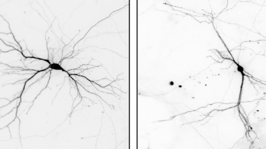 The picture shows cultured neurons prepared from brains of control mice (left) and mice in which the Nek7 gene is knocked out. The dendrites are overall shorter and less branched  in NEK7 knockout neurons.