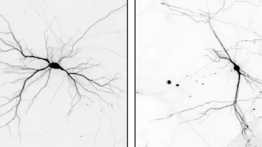   The picture shows cultured neurons prepared from brains of control mice (left) and mice in which the Nek7 gene is knocked out. The dendrites are overall shorter and less branched in NEK7 knockout neurons.