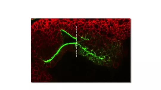 The cells to the right of the line, which have lost adhesion and are more rounded, will form the Drosophila intestines.