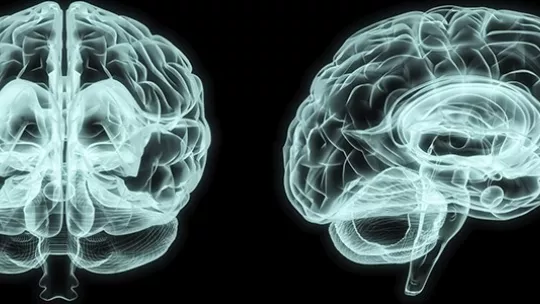 Imagen: Diabetes UK.