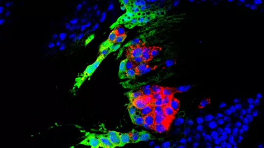 Células precursoras para formar el ala de mosca, marcadas para distintas proteínas. En este modelo, los científicos han estudiado la relación entre inestabilidad cromosómica, aneuploidía y tumorogénesis (Lara Barrio, IRB Barcelona)