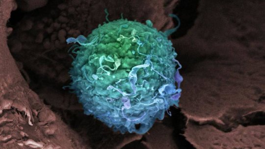 Breast cancer cell. Image: GETTY, El País. 