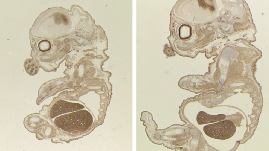 Cross sections of wild type or TLK2 deficient embryos stained for the proliferative marker Ki67. Embryos lacking TLK2 (left) appear morphologically normal but developmentally delayed. (S. Segura-Bayona, IRB Barcelona)
