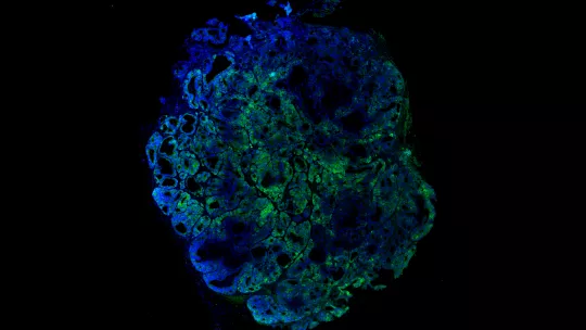 Células madre tumorales, en verde (G. Turon, IRB Barcelona)