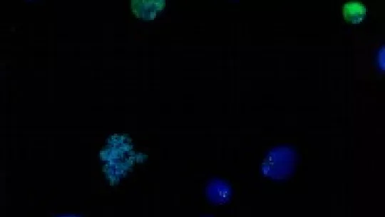 Els centròmers (a la imatge) són essencials durant la segregació de cromosomes i la proliferació cel·lular. la seva funció ve determinada epigenèticament per una variant de la histona H3. Imatge cedida per Olga Moreno, IRB Barcelona